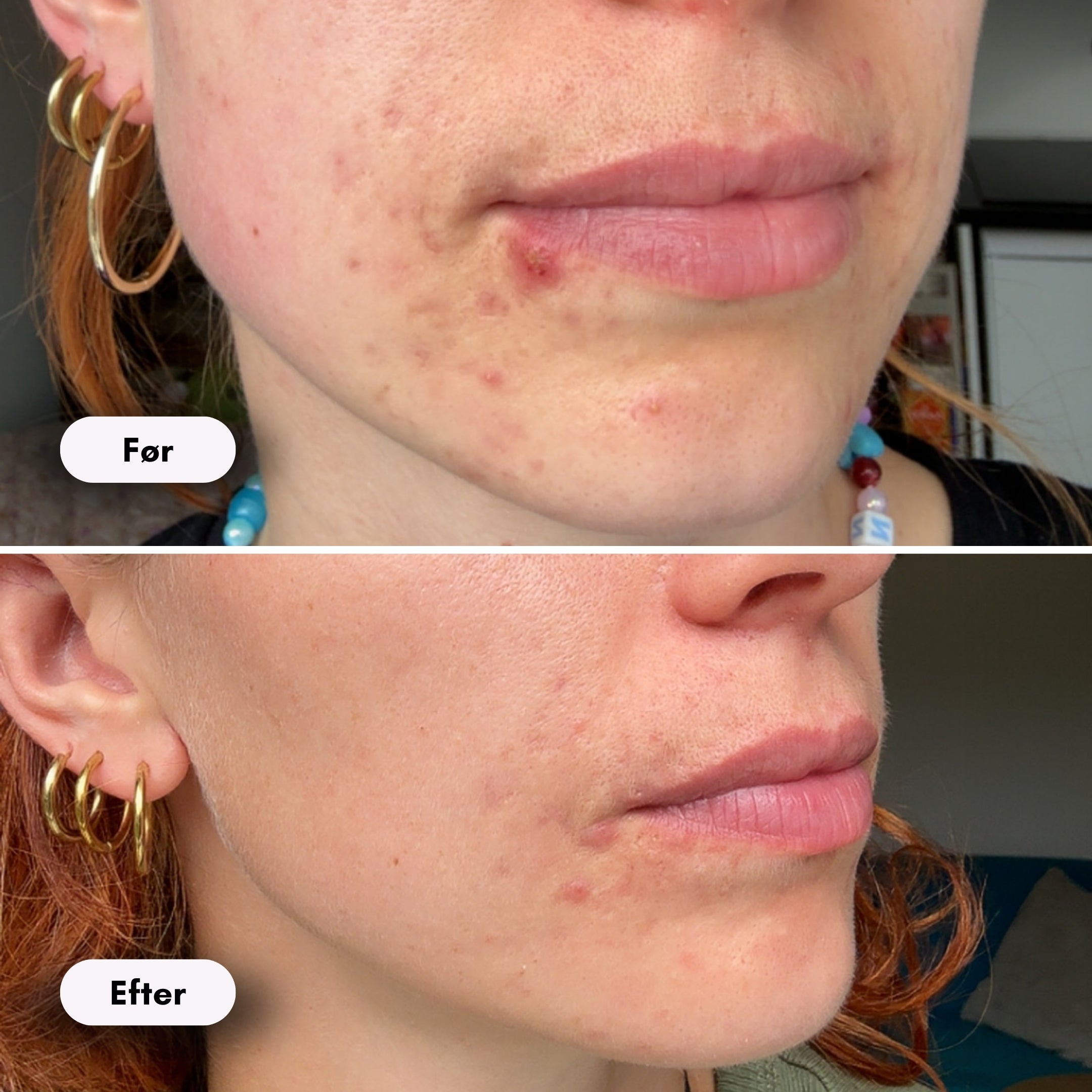 ScandiGlow Radiance - Lysterapi Maske