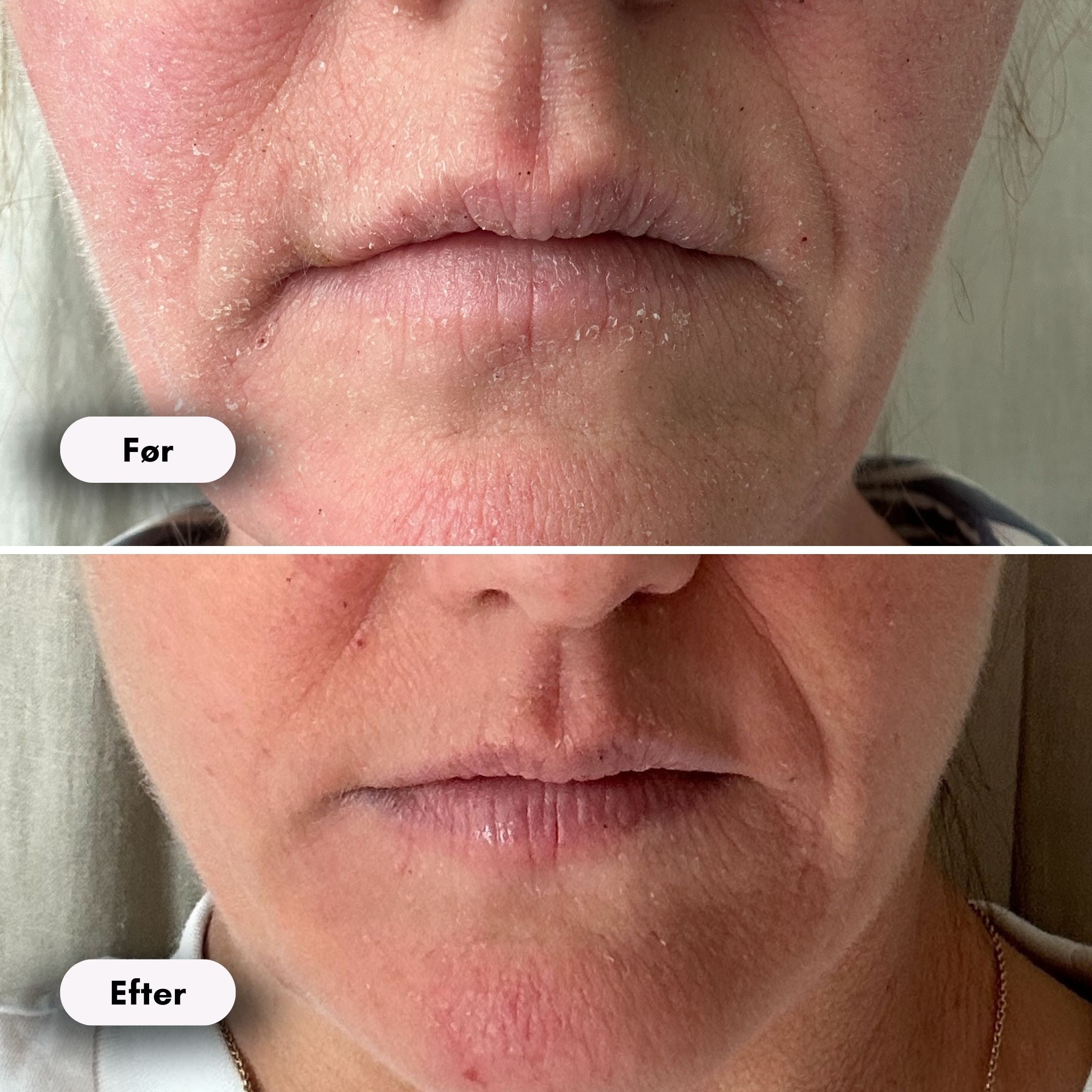 ScandiGlow Radiance - Lysterapi Maske