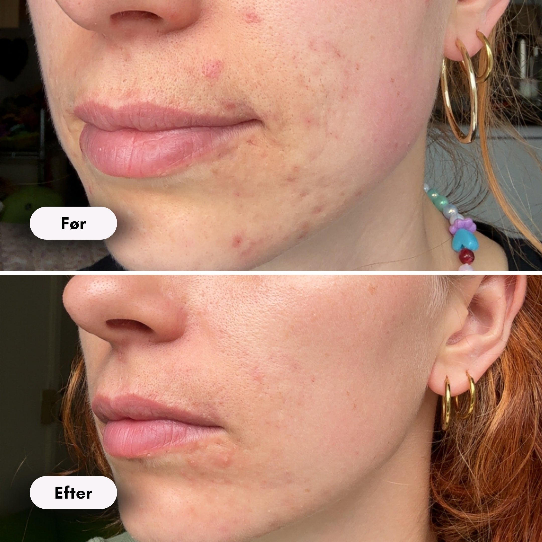 ScandiGlow Radiance - Lysterapi Maske