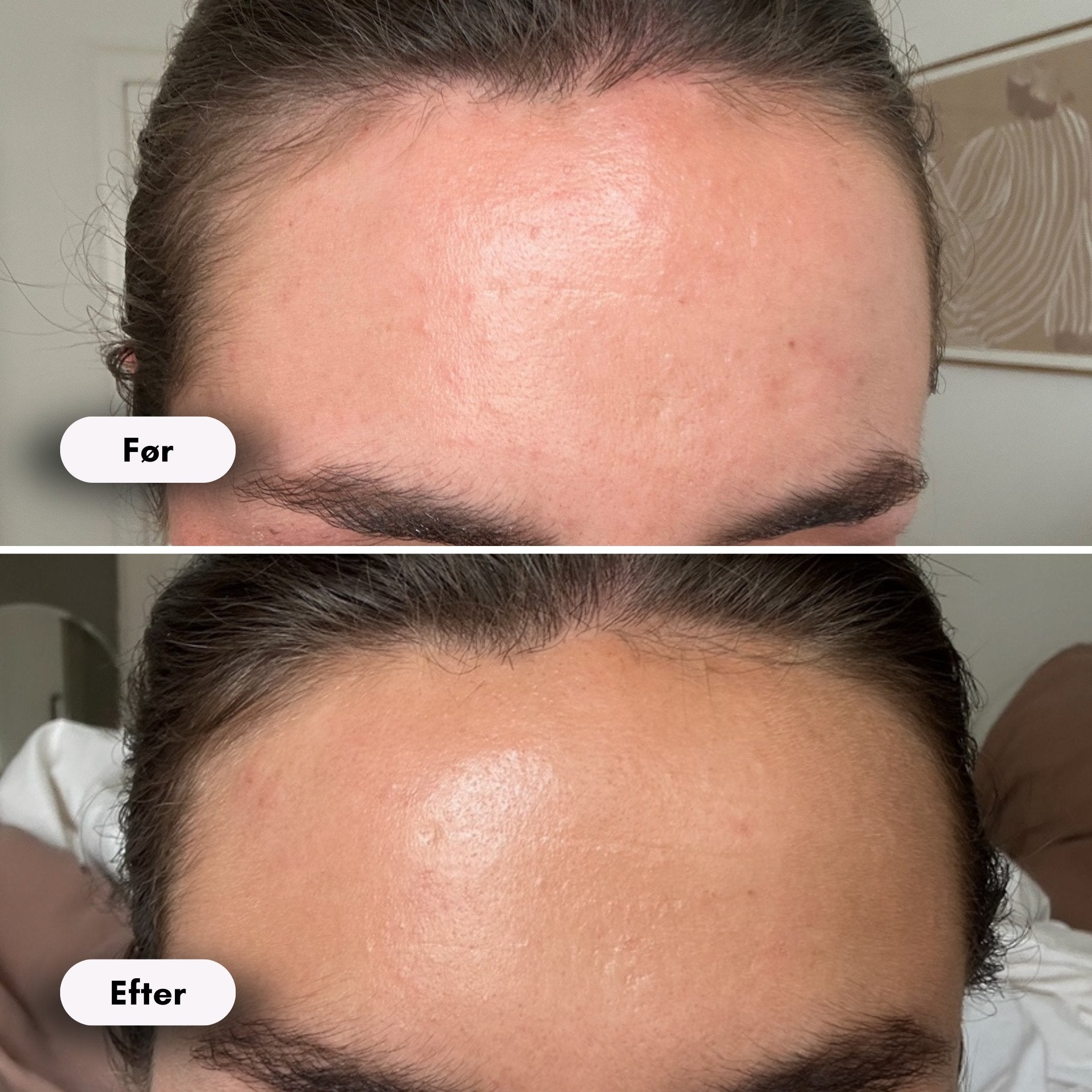 ScandiGlow Radiance - Lysterapi Maske