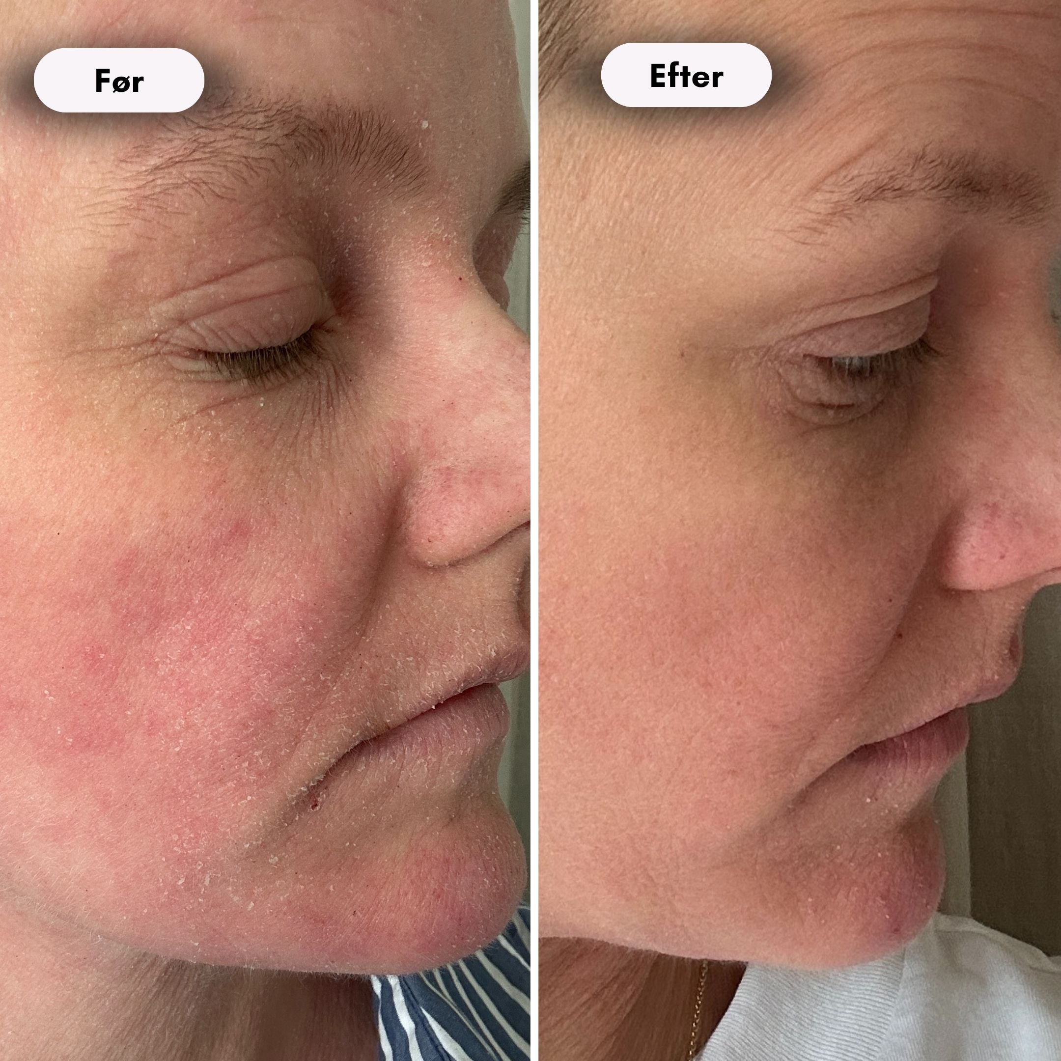 ScandiGlow Radiance - Lysterapi Maske